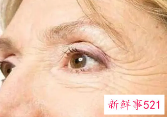 去眼角纹最好的办法