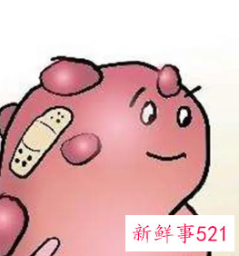 多囊肾婴儿出生一切正常