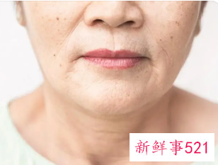 去眼角纹最好的办法