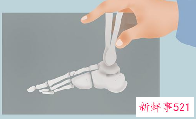 骨折和扭伤的区别