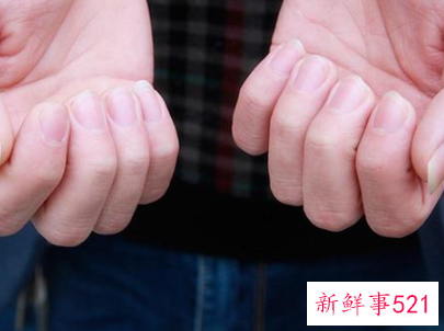 长倒刺缺的原因