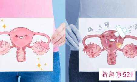 疤痕子宫孕几个月最危险