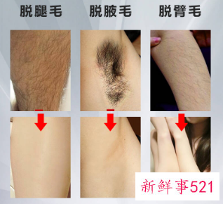 女生说脱毛是指哪里