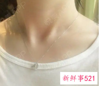 怎样判断是不是天鹅颈