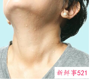 虚汗出多了会怎样