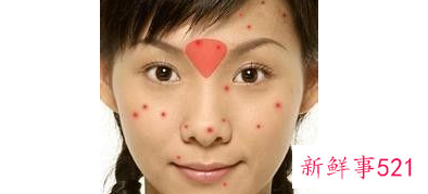 脸上长痘对应五脏示意图