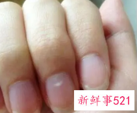 手指甲上有小点点是什么原因