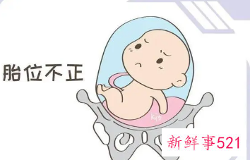 臀位男孩胎动表现
