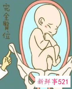 臀位男孩胎动表现