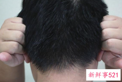 男性衰老的七个信号