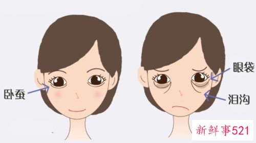 轻松赶走眼袋的方法