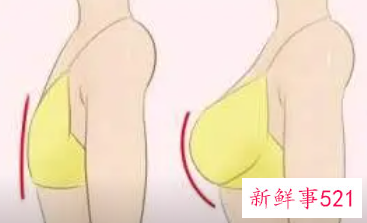 自体脂肪丰胸的后遗症有哪些