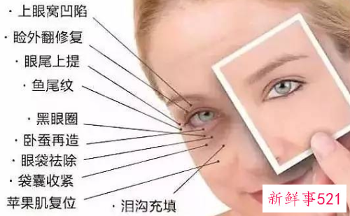 什么方法瞬间消除眼袋