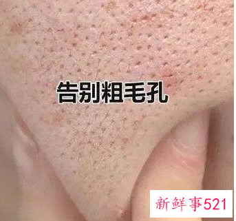 脸上毛孔堵塞怎么清理的