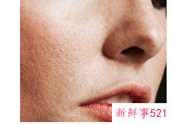 如何改善全身皮肤干燥起皮