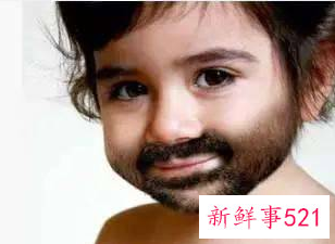 男孩性早熟不良表现