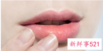 纹唇三年后很丑图片