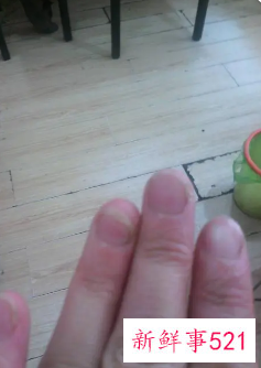 指甲宽扁有什么办法改善