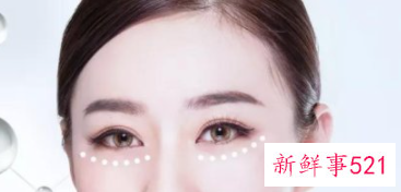 黑眼圈和眼袋怎么样消除