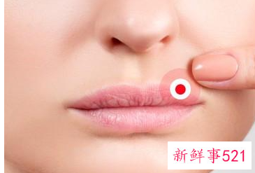 嘴角老脱皮擦什么好