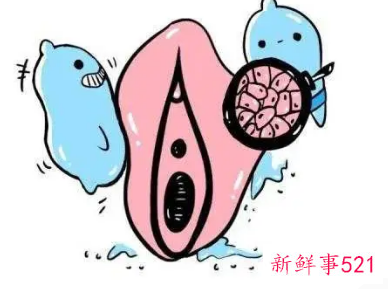 外阴白斑是怎样导致的