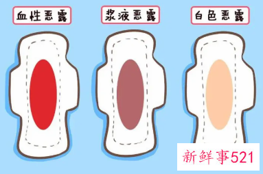 产后恶露是什么