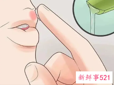 嘴角起泡是缺少什么维生素