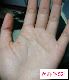 手心太糙太干怎么办