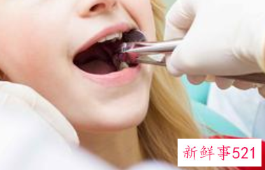 拔牙出血与疼痛的护理方法