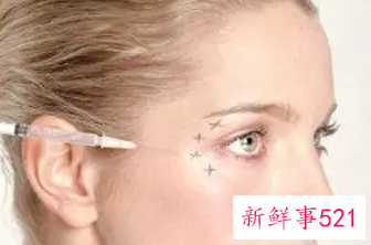 让皱纹消失的方法