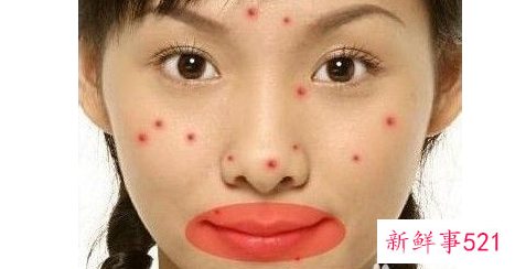 脸上长痘对应五脏示意图