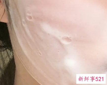 长期不用洗面奶的好处