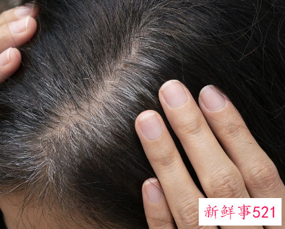 用盐和醋洗头疯长头发