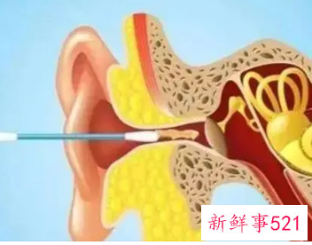 自己挖耳屎会碰到耳膜吗