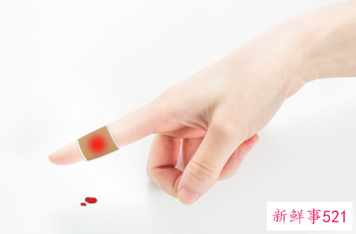 梦见手被咬出血