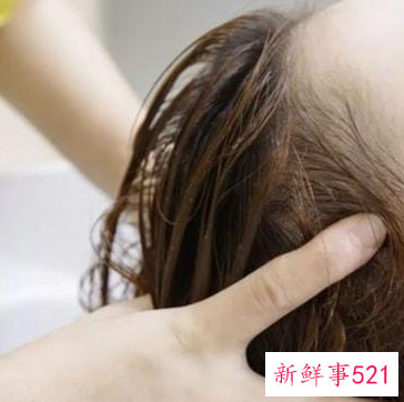 用盐和醋洗头疯长头发