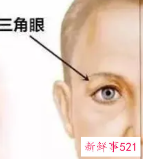 眼皮松弛该怎么办