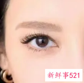 双眼皮眼角宽后面窄