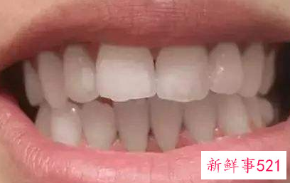 牙齿黄怎么办而且容易出血