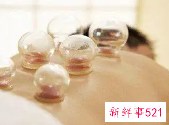 女人拔罐有好处吗