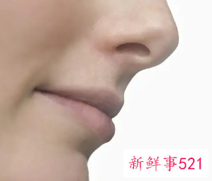 怎样让鼻子变挺