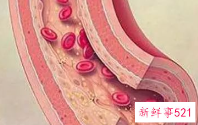 为什么运动有利于健康