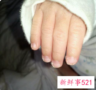 怎样保持指甲缝里不脏