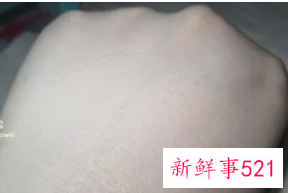 肌肤纹理是什么