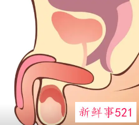 男科性功能检查流程