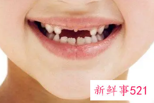 女人梦见补的牙齿填充物掉了