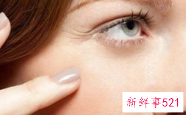 什么去皱纹最好