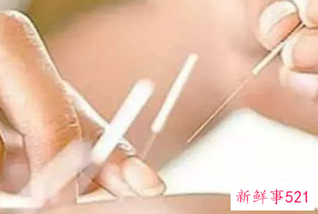 埋线减肥的风险有哪些