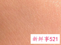 肌肤纹理是什么