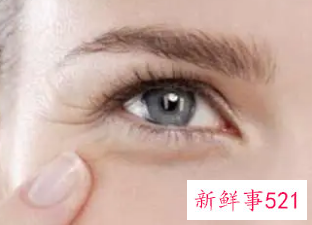 怎样消除眼部周围的皱纹